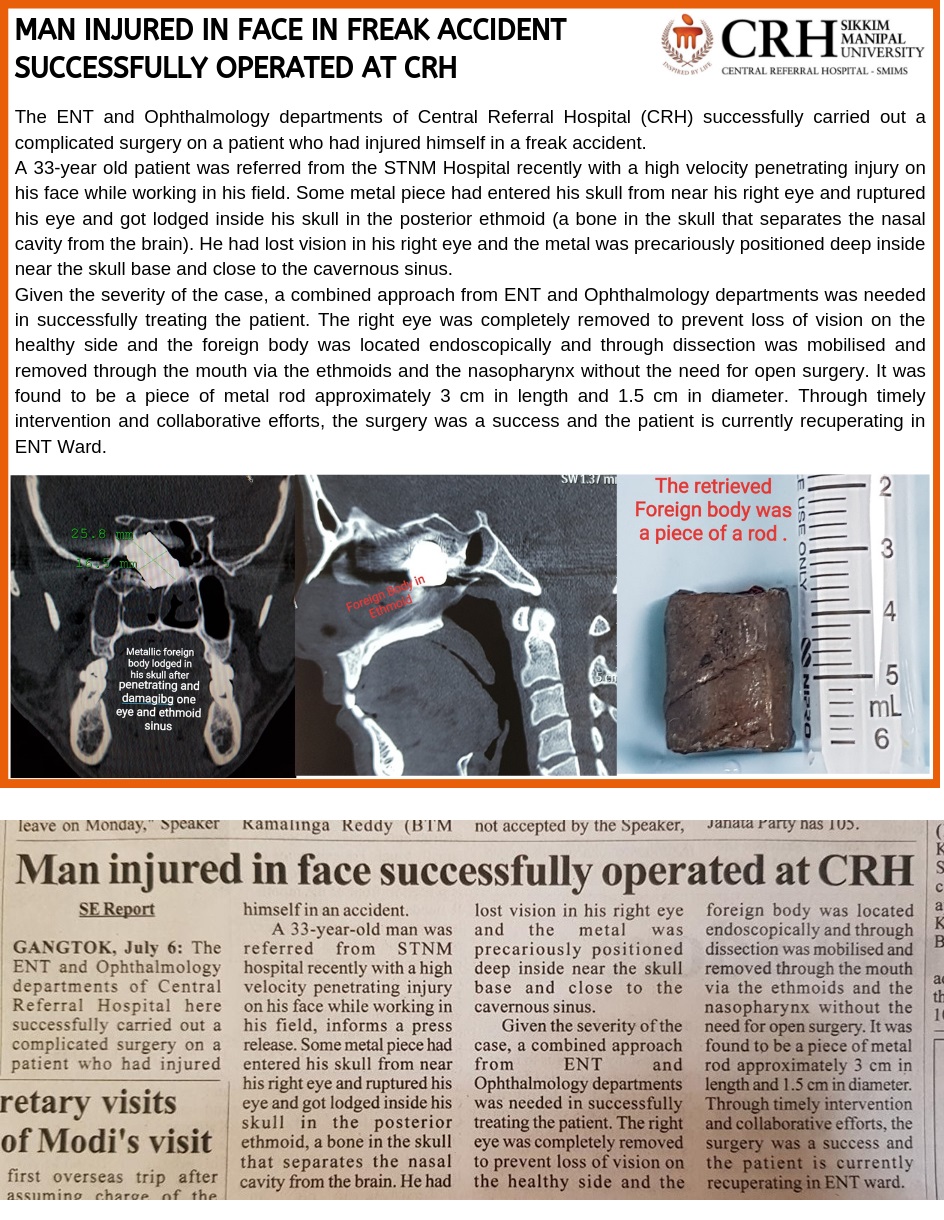 Man Injured In Face Freak Accident Successfully Operated at CRH